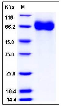 SDS-PAGE analysis of human BRAG His tag protein