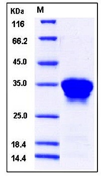 SDS-PAGE analysis of Human OSM His tag protein