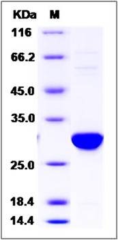 SDS-PAGE analysis of Human UBASH3B protein (His Tag)