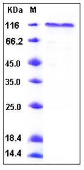 SDS-PAGE analysis of human COMP His tag protein