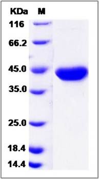 SDS-PAGE analysis of human GAL protein