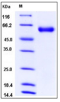 SDS-PAGE analysis of mouse SerpinA8 His tag protein