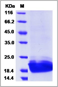 SDS-PAGE analysis of Mouse PGLYRP1 His tag protein