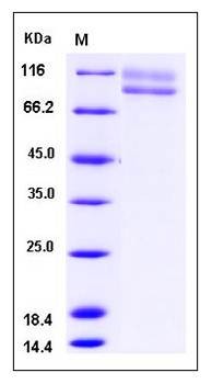 SDS-PAGE analysis of Human IL17RC protein