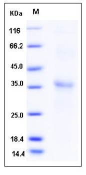 SDS-PAGE analysis of Human RGMA protein (His Tag)