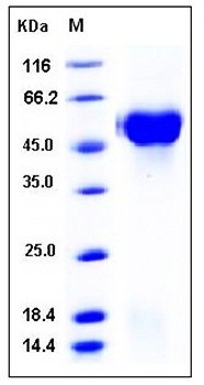 SDS-PAGE analysis of human ST6GAL1 His tag protein
