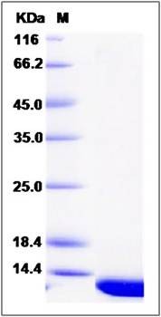 SDS-PAGE analysis of Human PDRG1 protein (His Tag)
