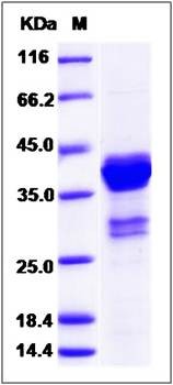 SDS-PAGE analysis of Human MKI67 protein (GST Tag)
