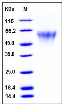 SDS-PAGE analysis of human TREML2 His tag protein