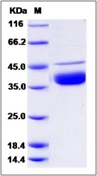 SDS-PAGE analysis of human DNASE1 protein (His Tag)
