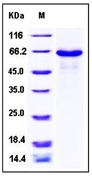 SDS-PAGE analysis of Human PCSK1 His tag protein