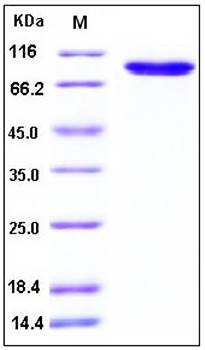 SDS-PAGE analysis of Human DDR2 Fc tag protein