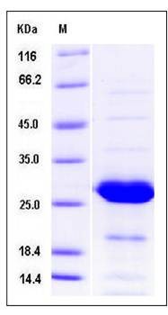 SDS-PAGE analysis of Human PSPH protein (Native)