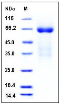 SDS-PAGE analysis of Mouse LY9 His tag protein