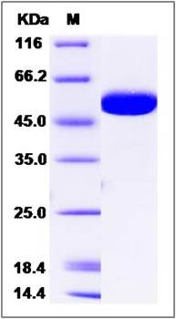 SDS-PAGE analysis of human B3GALTL protein (His Tag)