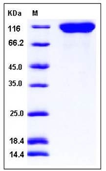 SDS-PAGE analysis of Human CD22 His tag protein