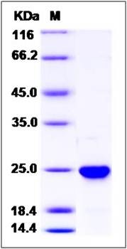 SDS-PAGE analysis of Human NRAS protein (His Tag)