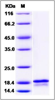 SDS-PAGE analysis of human FGF6 protein (Native)
