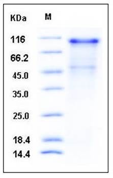 SDS-PAGE analysis of human CDH16 His tag protein