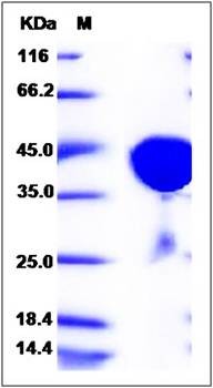 SDS-PAGE analysis of human GOT1 protein (His Tag)