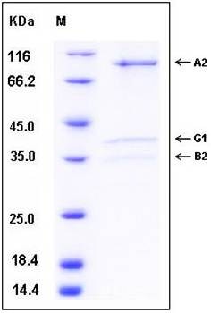 SDS-PAGE analysis of human AMPK protein