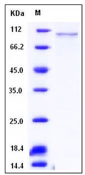 SDS-PAGE analysis of mouse AGO2 His tag protein