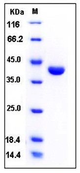 SDS-PAGE analysis of Human PGC His tag protein