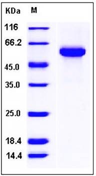 SDS-PAGE analysis of human FETUB His tag protein