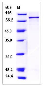 SDS-PAGE analysis of human CAMKV His GST tag protein