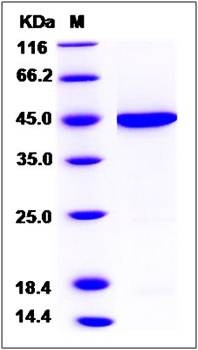 SDS-PAGE analysis of Human PLEK protein (His Tag)
