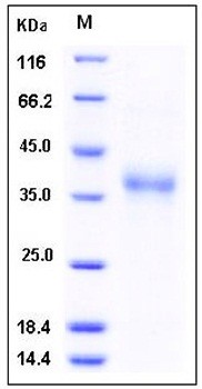 SDS-PAGE analysis of Human IL17 Receptor B flag tag protein