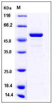 SDS-PAGE analysis of human FKBP3 GST tag protein