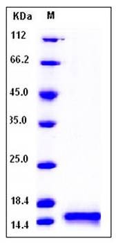 SDS-PAGE analysis of human Cystatin B His tag protein