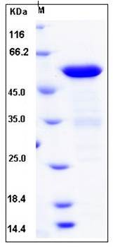 SDS-PAGE analysis of human BIN1 His tag protein