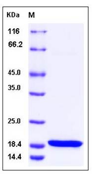 SDS-PAGE analysis of Human PAF protein (His Tag)