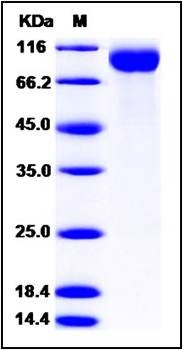 SDS-PAGE analysis of human CD22 protein (His Tag)