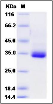 SDS-PAGE analysis of mouse SDC4 protein
