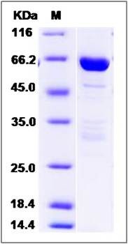 SDS-PAGE analysis of human DCLK1 protein