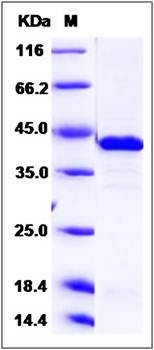 SDS-PAGE analysis of Human MAPK14 protein (His Tag)