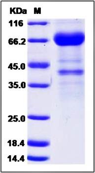 SDS-PAGE analysis of Canine IL2RB protein