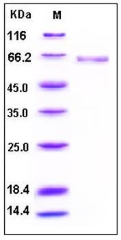 SDS-PAGE analysis of human ALPL His tag protein