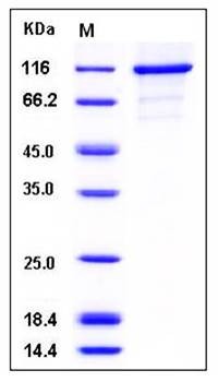 SDS-PAGE analysis of human CASK His GST tag protein