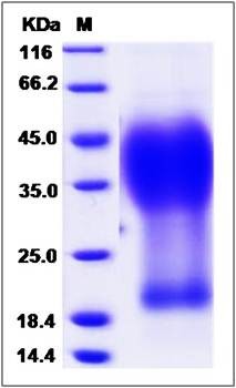 SDS-PAGE analysis of Human GYPA protein (His Tag)