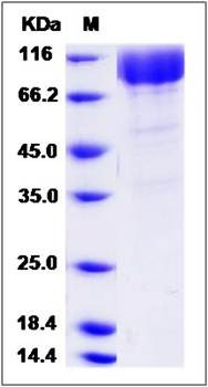 SDS-PAGE analysis of Cynomolgus PDGFRB protein (His Tag)