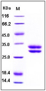 SDS-PAGE analysis of Human JAMA His tag protein