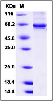 SDS-PAGE analysis of human SHPK protein (GST Tag)