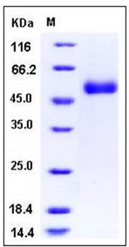 SDS-PAGE analysis of human ACPL2 His tag protein