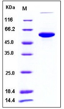 SDS-PAGE analysis of Human P4HB His tag protein