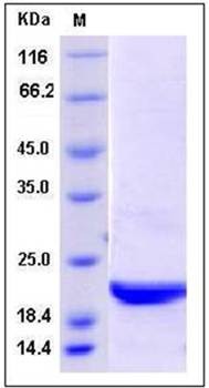 SDS-PAGE analysis of Human UBE2H protein
