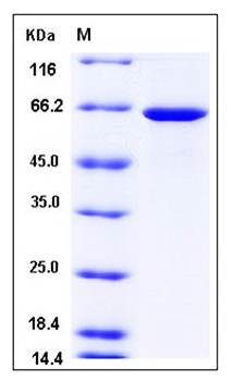 SDS-PAGE analysis of human GBP1 protein (His Tag)